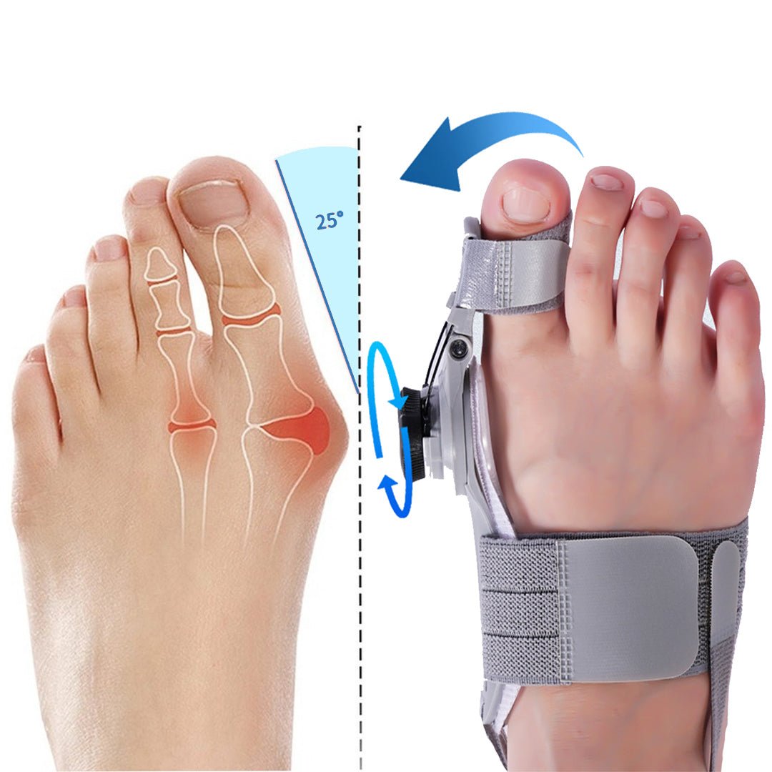 Ony™️ - Correcteur d'oignons d'hallux valgus - Faramys - 